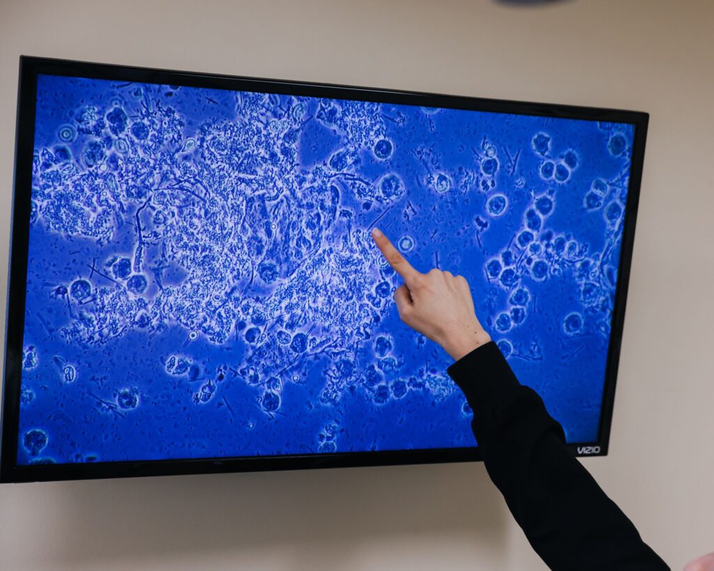 Hand pointing at magnified dental sample on monitor screen
